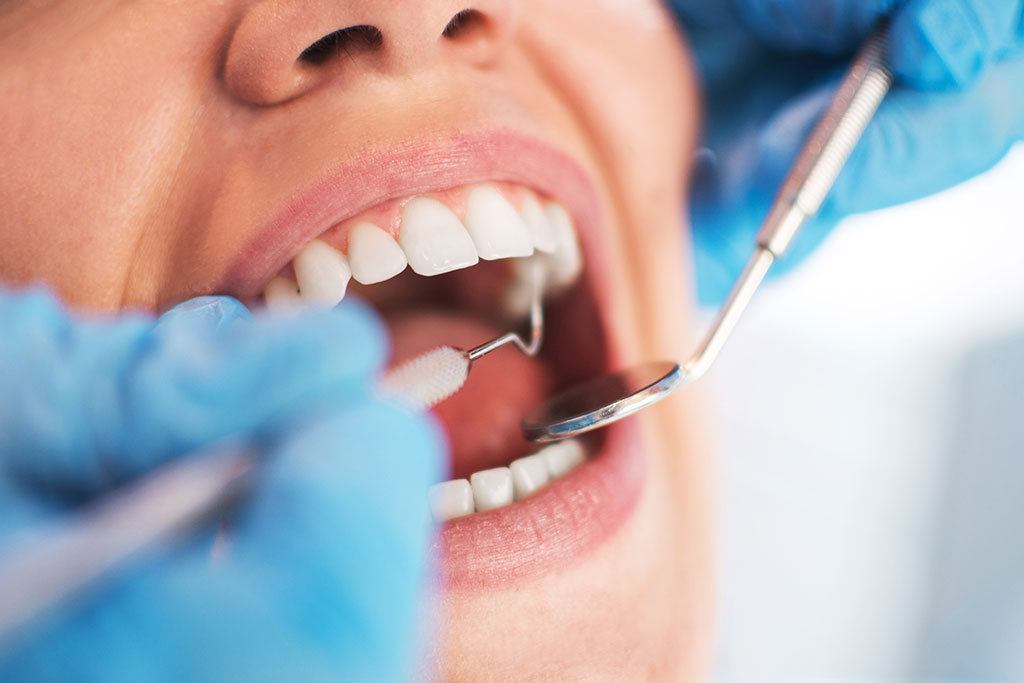 No es necesario remediar todo trastorno dental con una corona.